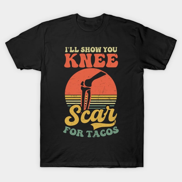 Knee Surgery Shirt | Show Knee Scars For Tacos T-Shirt by Gawkclothing